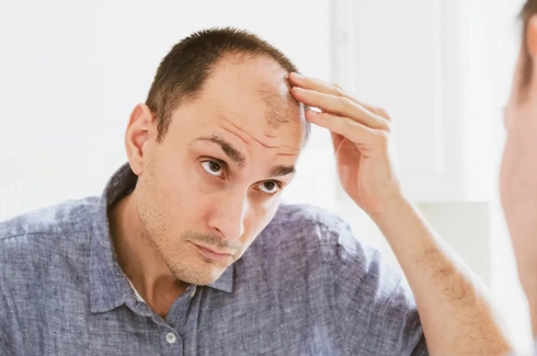 Who Can Have A Hair Transplantation?